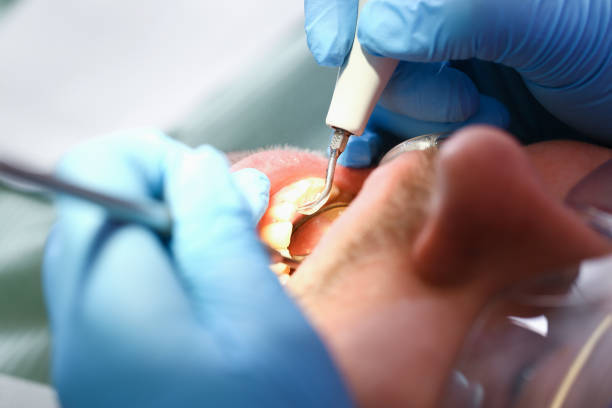 Best Holiday Emergency Dentist in Lake Barrington, IL